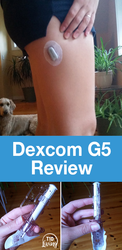 Dexcom G5 Review