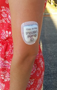 this is my insulin pump T1D Life