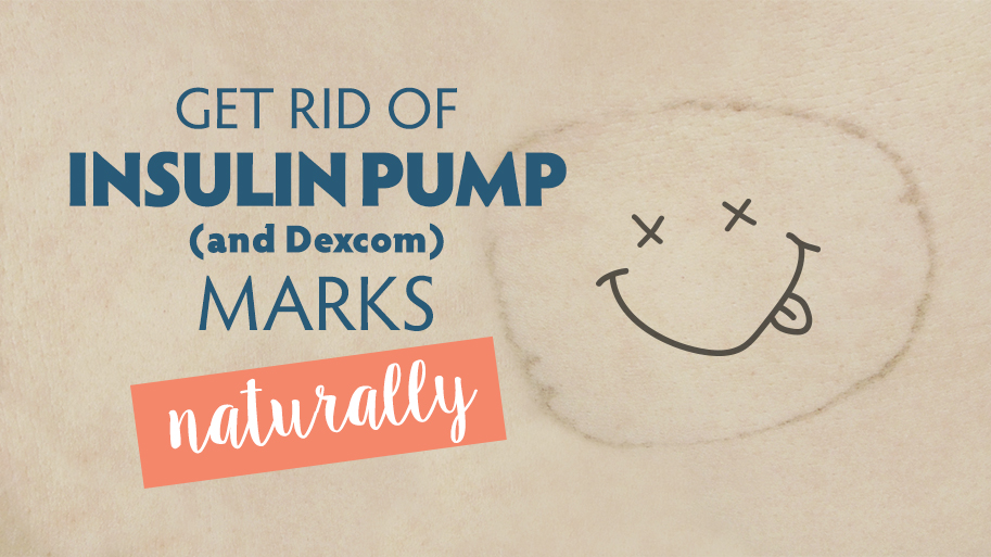 Get rid of insulin pump marks naturally