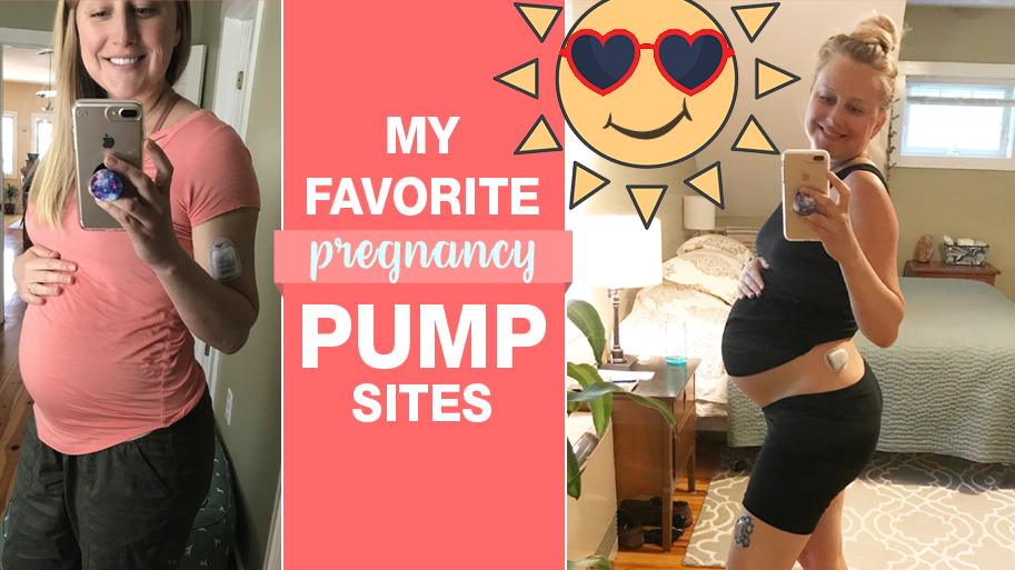 Favorite-Pump-Sites-During-Pregnancy-T1D