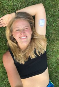 girl with type 1 diabetes laying in grass with arm overhead showing tubeless insulin pump