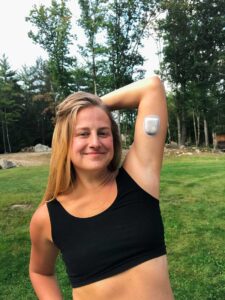 girl with type 1 diabetes wearing omnipod insulin pump on arm