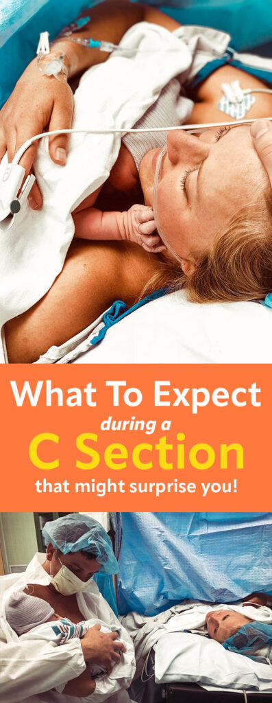 what to expect during a diabetic c section